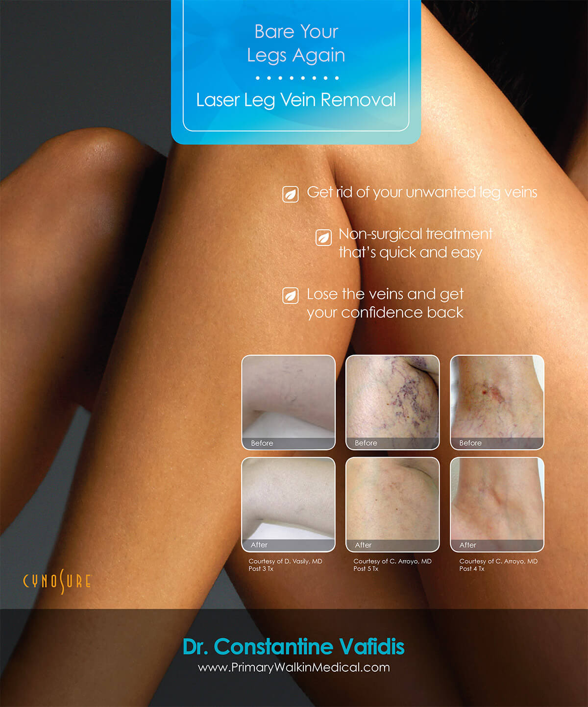 Pigmentation and Vein Removal